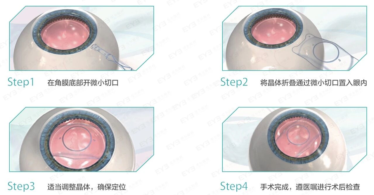 dafab7fad8f5aea33edf290207cccd7b.jpg
